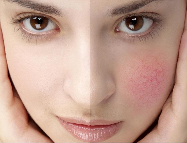 敏感肌換季如何護(hù)理？