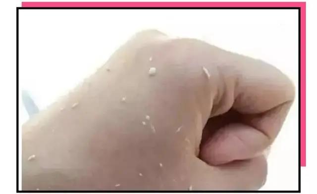 使用護膚品搓泥的原因有哪些？護膚品搓泥怎么辦？